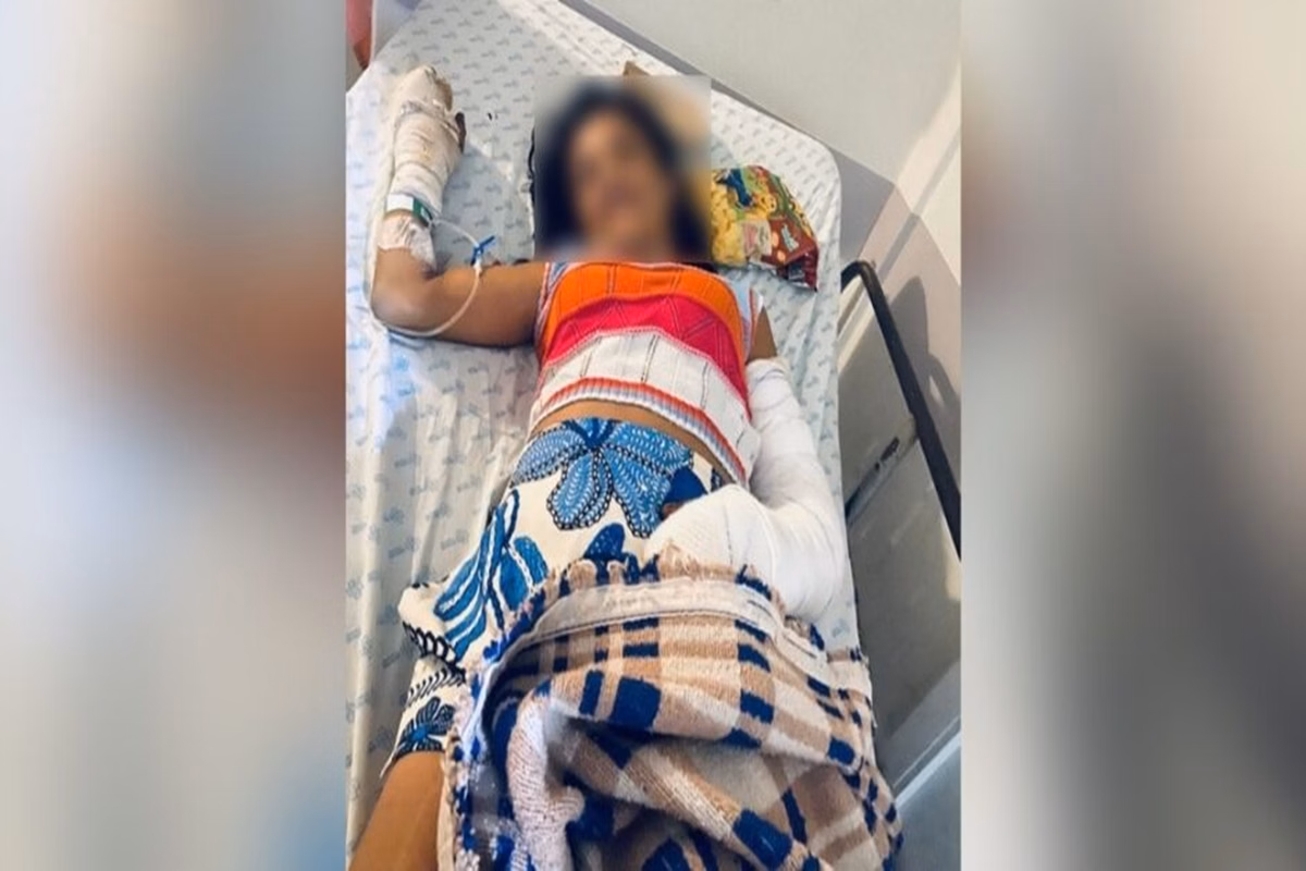 mulher-agredida-com-2-bracos-quebrados-espera-cirurgia-ha-4-dias